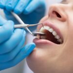 Dentist in Balmain: Comprehensive Dental Care